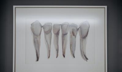 什么是根管治疗？一颗坏牙的“内部拯救计划”！